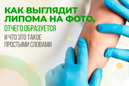 липома